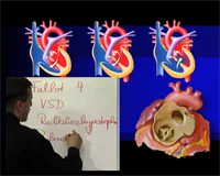 Loadmedical - Medizinische Filme - Crash-Kurs Medizin: Herz - Kreislauf - Blut - Das komplette Video