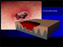 Loadmedical - Medizinische Filme - Crash-Kurs Medizin: Haut - Das komplette Video