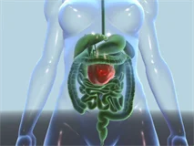 Loadmedical - Medizinische Filme - Onkologie - Das komplette Video